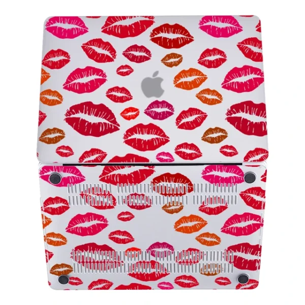 Full Coverage Lips MacBook Case